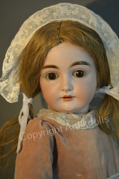 Kestner 146 Kestner 146